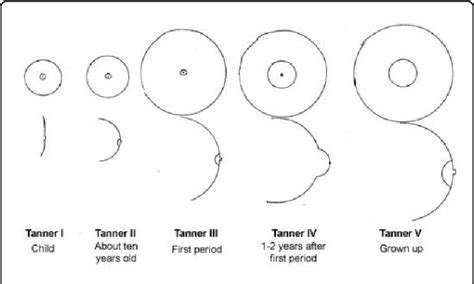 Problems with breast development